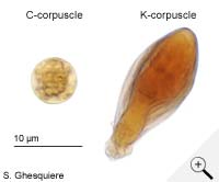 corpuscles